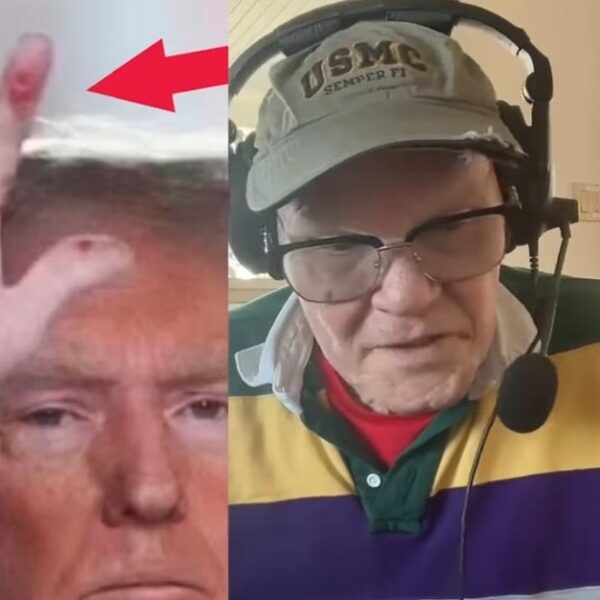 Left-Wing Media Freaks Over ‘Mysterious Crimson Marks’ on Trump’s Hand – Dem…