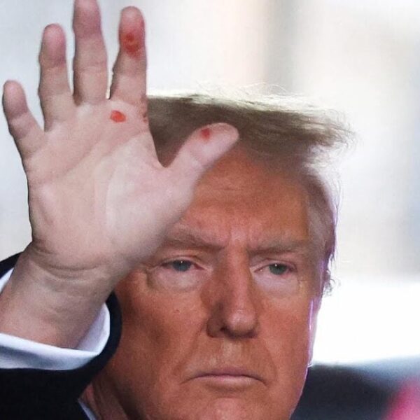 Trump Responds to Rumors About Purple Marks on His Hand | The…
