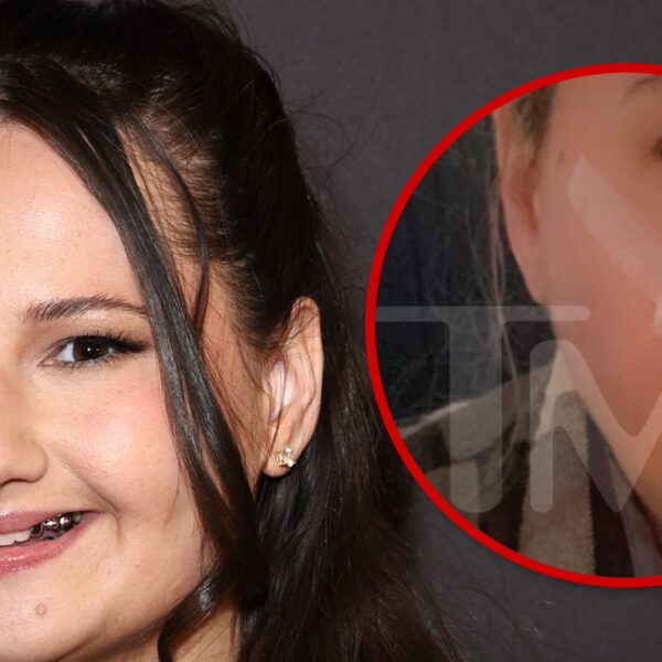 Gypsy Rose Blanchard Recovering in First Look After Nostril Job