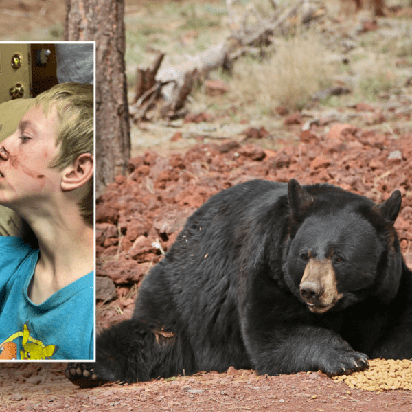 Arizona teenage survives black bear assault in Alpine: ‘A blessing’