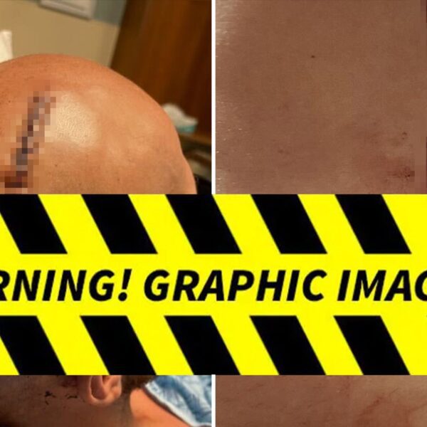 Man Stabbed In 2 Cold Scorpio Fight Needed Staples, Stitches, Horrific Pics…