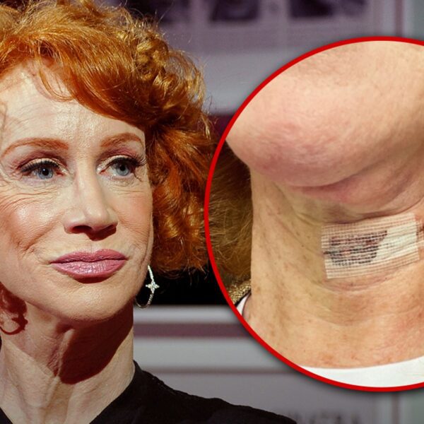 Kathy Griffin Shares IG Pic After Second Vocal Cord Surgery