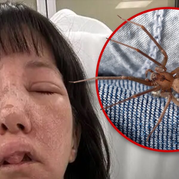 Georgia Woman Suffers Horrible Injuries After Attack from Deadly Spiders