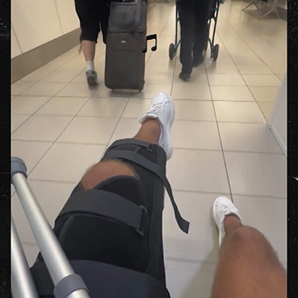 Former ‘Love Island’ Contestant Luca Bish Shows Off Injured Leg