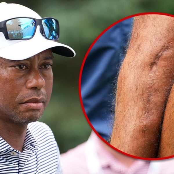Tiger Woods Shows Off Gnarly Leg Scars Three Years After Car Crash