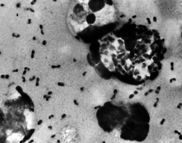 Public Health Officials Warn of Human Plague Case in Colorado | The…
