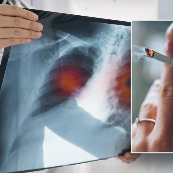 Learn extra about lung most cancers, the illness that impacts 1000’s of…