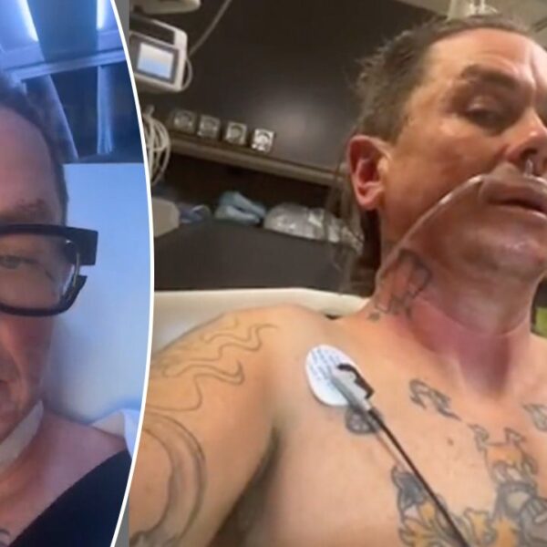 Slipknot’s Sid Wilson hospitalized with extreme burns after explosion at farm