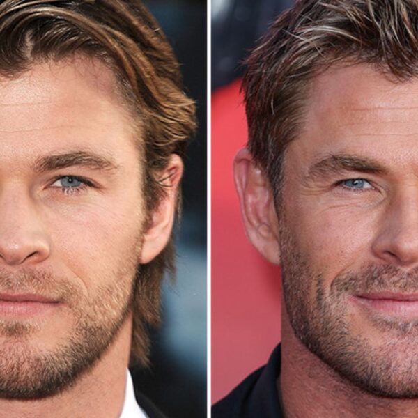 Chris Hemsworth — Good Genes or Good Docs?!