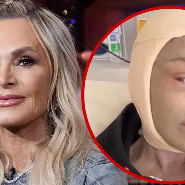 ‘RHOC’ Tamra Judge Documents Brow Lift, Face Peel Post-Op