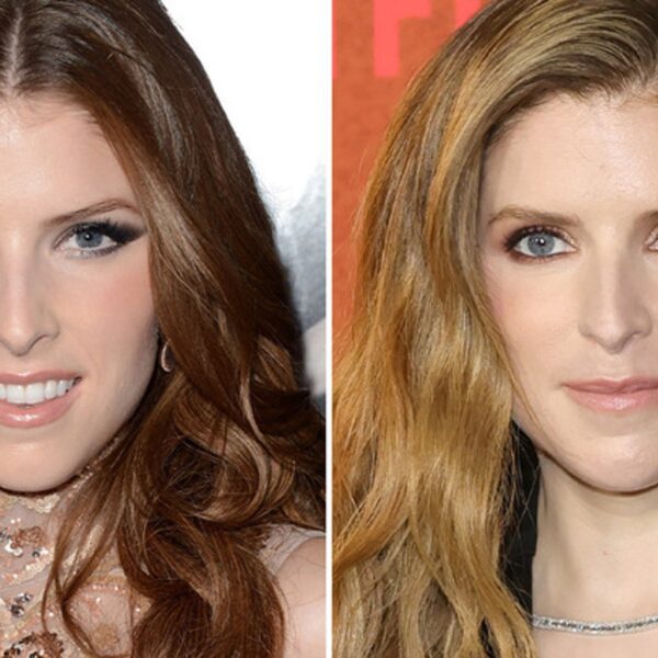 Anna Kendrick — Good Genes or Good Docs?!