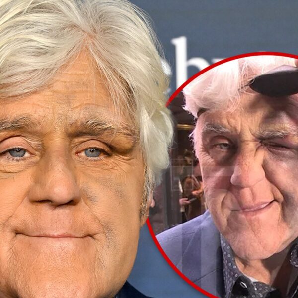 Jay Leno Looking Better After Nasty Fall Did Serious Damage to His…