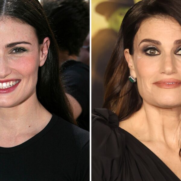 Idina Menzel — Good Genes or Good Docs?!