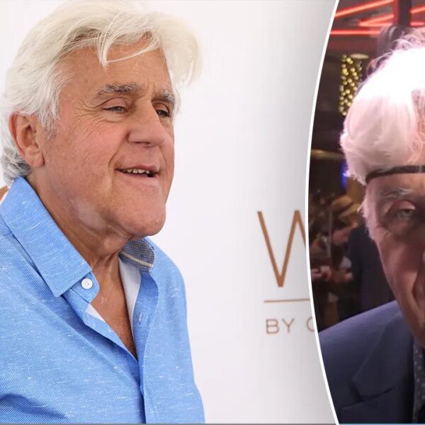 Jay Leno covers face accidents with eye patch after nasty fall