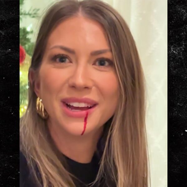 Stassi Schroeder Left Dripping Blood After a ‘Wicked’ Hit to the Face