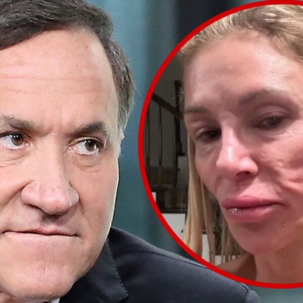 Dr. Terry Dubrow Explains Brandi Glanville’s Face Isn’t Because of Parasite