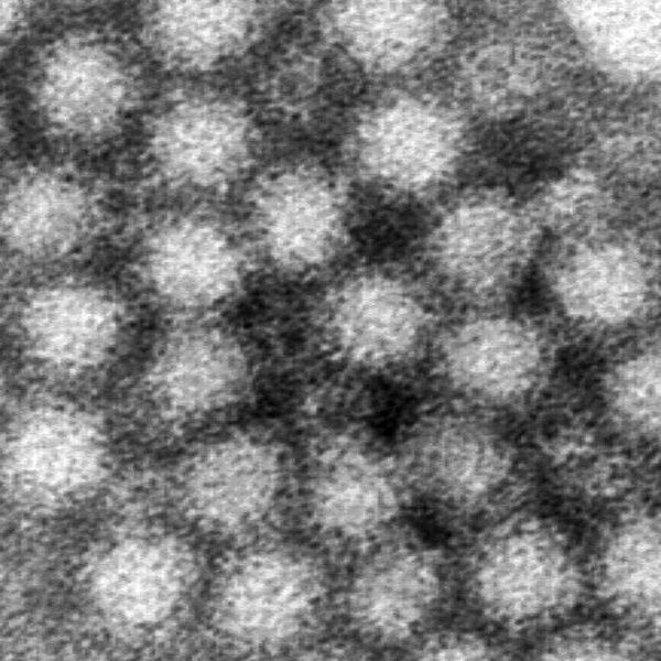 Norovirus circumstances are surging across the US and 40% above highs for…