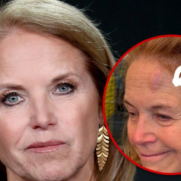 Katie Couric Debuts Nasty Forehead Bruise After Pickleball Accident