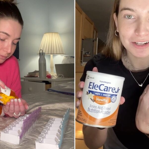 Woman who’s ‘allergic to all the pieces’ can solely eat these 2…