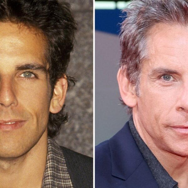 Ben Stiller — Good Genes or Good Docs?!