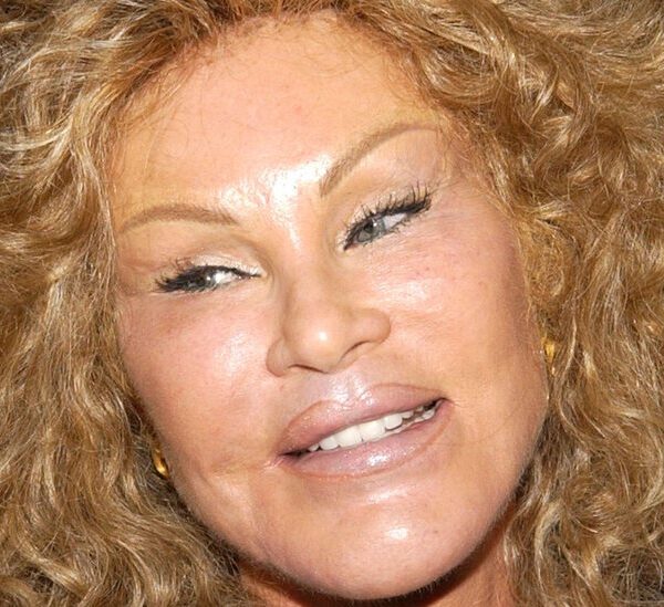 Jocelyne Wildenstein, Socialite and Tabloid ‘Catwoman,’ Dies at 79