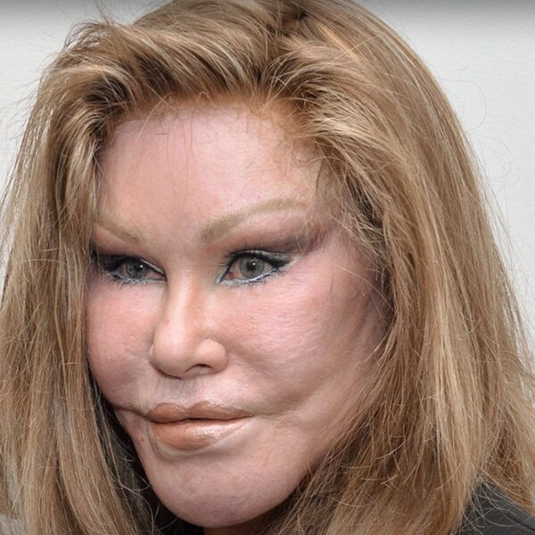 ‘Catwoman’ Jocelyn Wildenstein Dead At 84