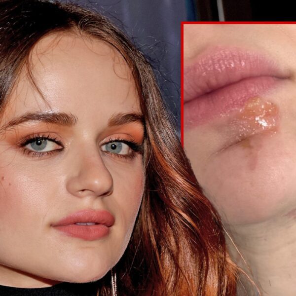 Joey King Ends Up With Facial Burns While Cooking Shallots in Hot…