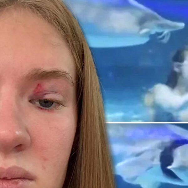 Mermaid Performer Says She Was Rushed to Hospital After Viral Fish Attack