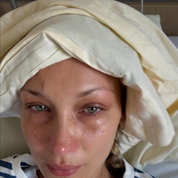 Bella Hadid Posts Cryptic Health Update After Going ‘MIA’