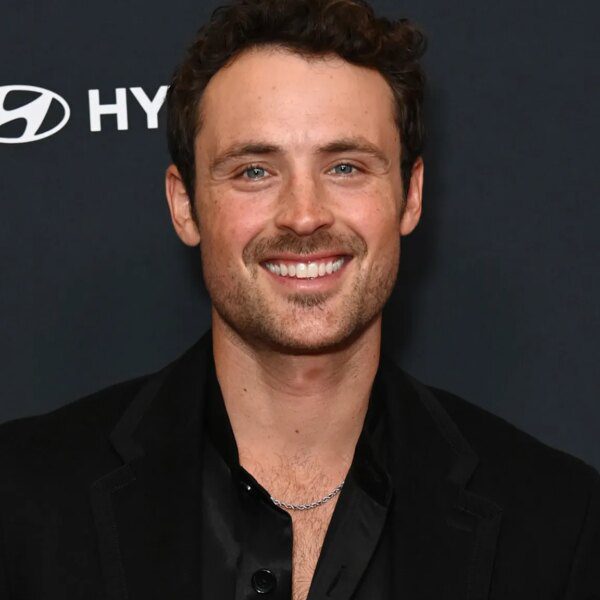 Dylan Efron Breaks Nose During ‘DWTS’ Rehearsals