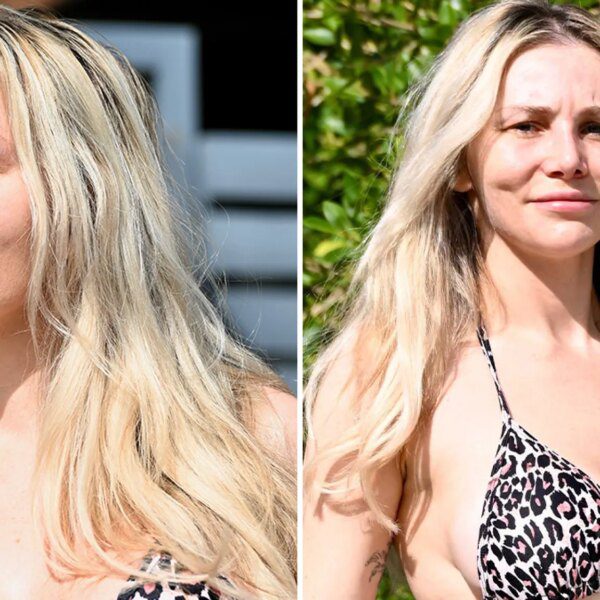 Courtney Stodden Shows Off Nose Job While Taking Out the Trash