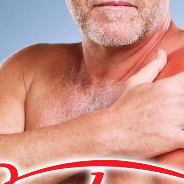 Sunbeam Sued By Man Who Claims Heating Pad Caused Skin Burns