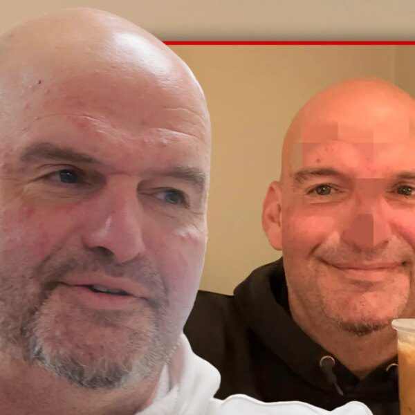 Senator John Fetterman Says He Needed 20 Stitches, Shares Photo of Banged…