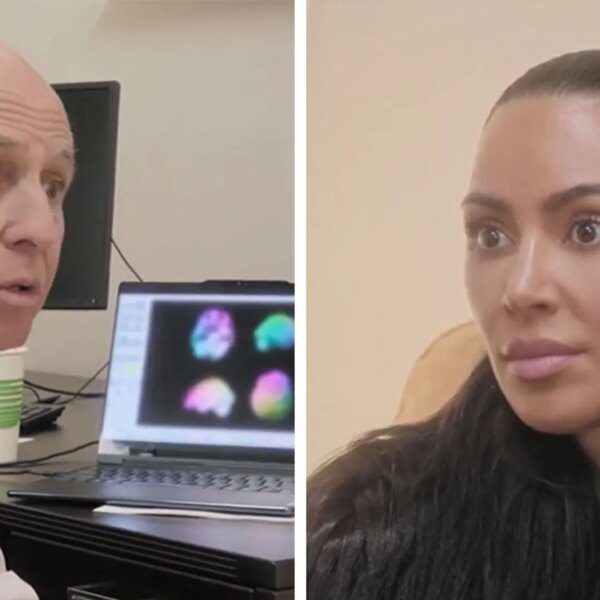 Kim Kardashian’s New Scan Shows Low Brain Activity, Studying Stress To Blame