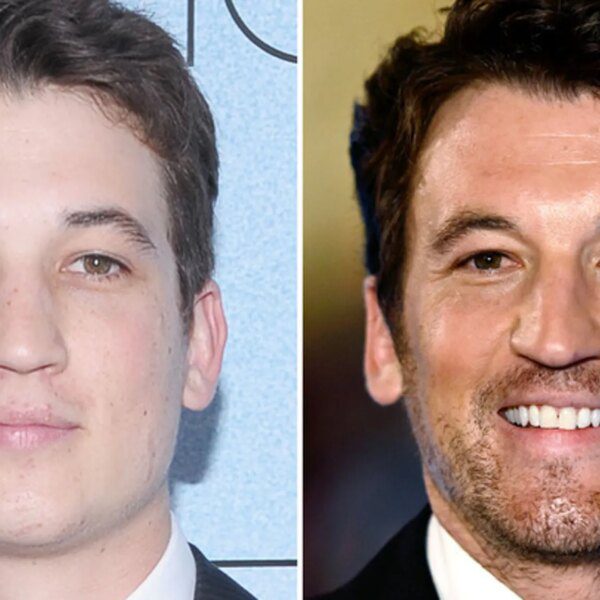 Miles Teller — Good Genes or Good Docs?!