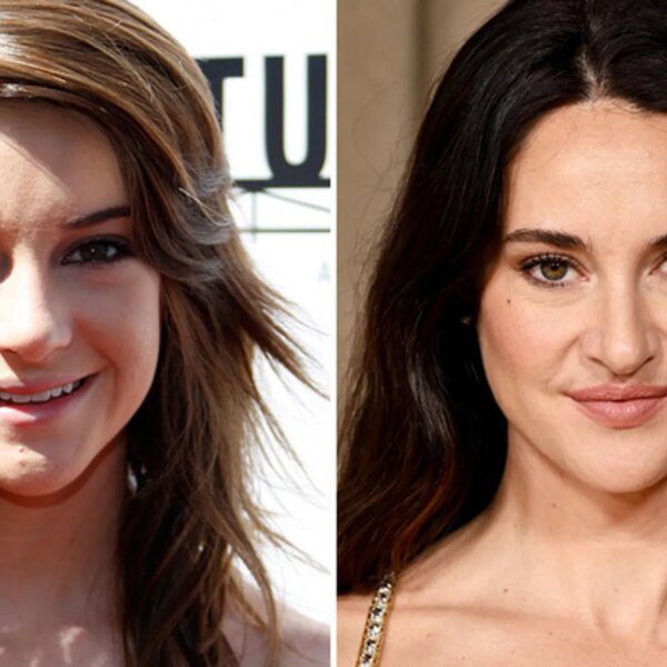 Shailene Woodley — Good Genes or Good Docs?!