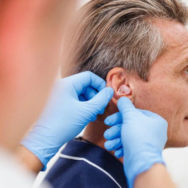 Researchers discover Viagra could reverse sure varieties of listening to loss