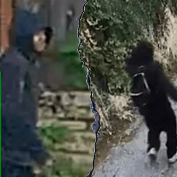 88-year-old girl hospitalized after finger bitten off in theft: police