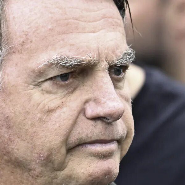 Bolsonaro undergoes medical process to deal with extreme hiccups