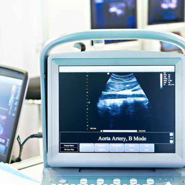 Butterfly Network: Behind The Big Rally