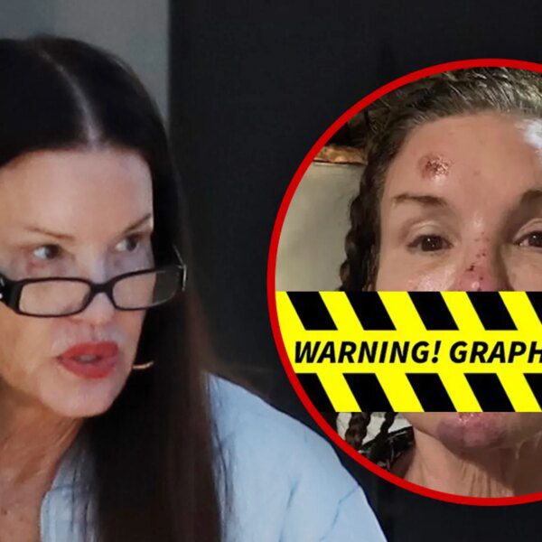 Janice Dickinson Spotted After Sharing Alleged Injuries From Reality Show Fall
