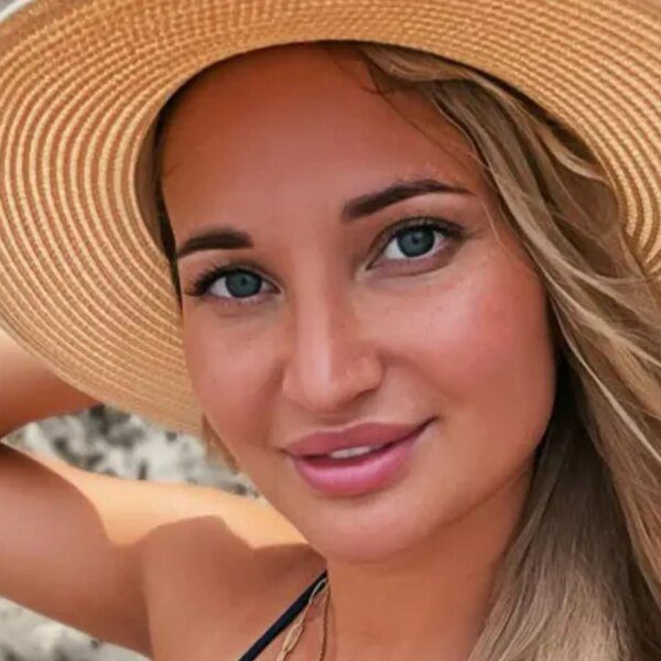 Influencer Yulia Burtseva Dies at 38 After Undergoing Cosmetic Surgery
