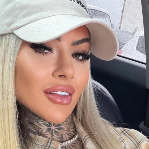 Glamorous Brazilian Influencer Bianca Dias Dead at 27 After Plastic Surgery