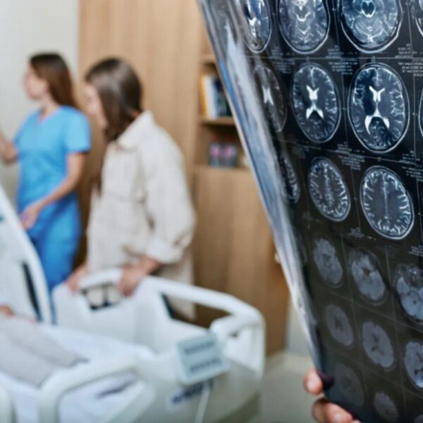 New wearable AI expertise restores speech for stroke dysarthria sufferers