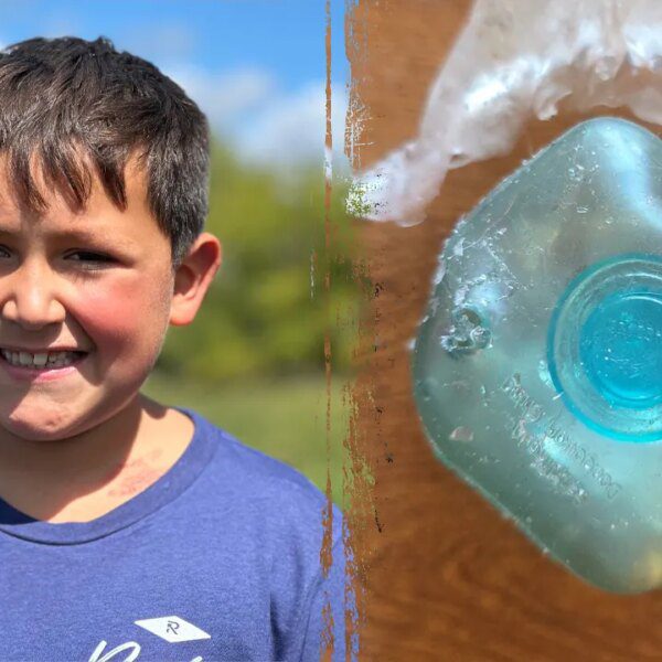 TikTok pattern leaves boy with extreme burns, medical doctors subject warning