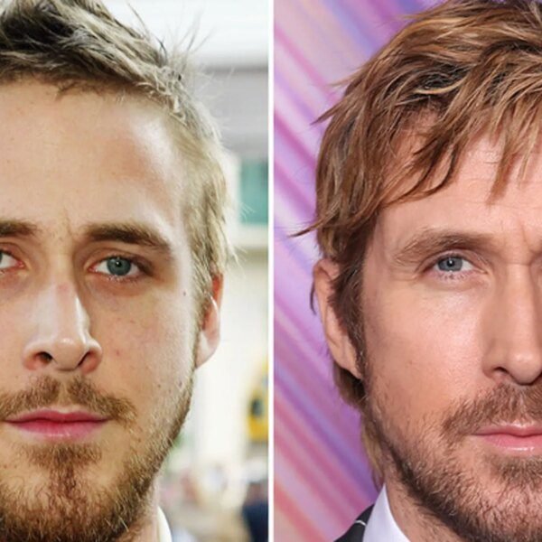 Ryan Gosling Good Genes or Good Docs?!