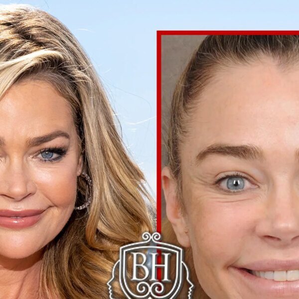 Denise Richards’ Before-and-After Pics Are Giving Her Surgeon’s Business a Lift