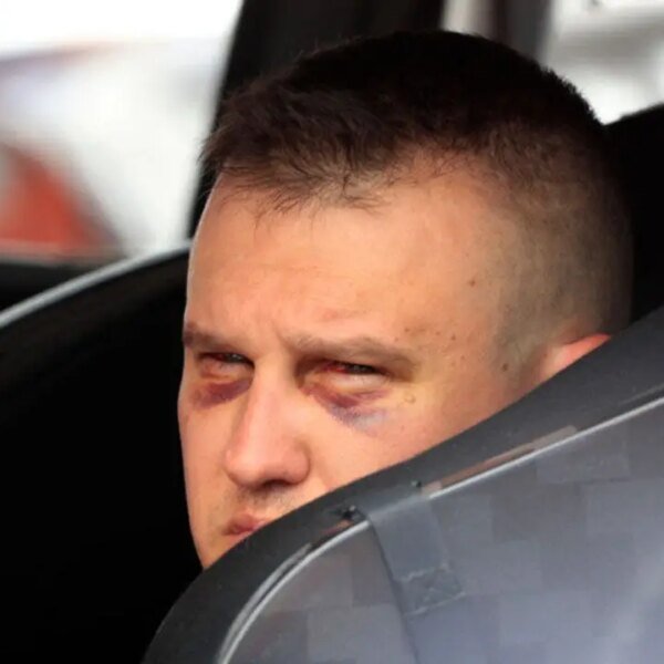 NASCAR driver who was left bloodied from horrifying Daytona crash has harsh&hellip;