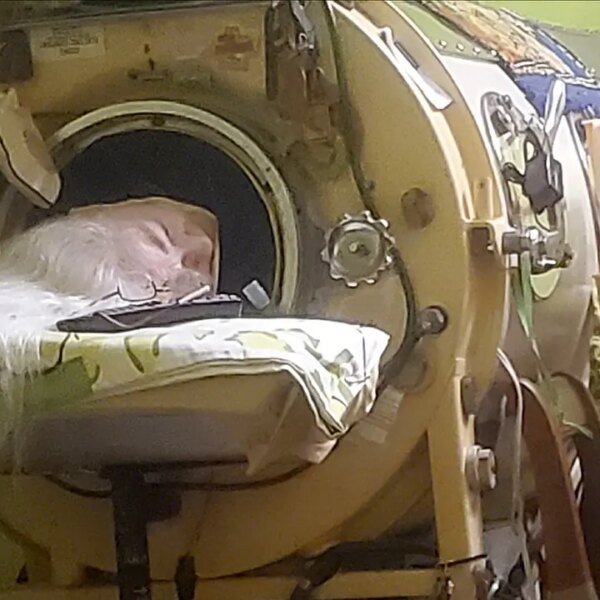 Polio survivor who was final American iron lung consumer dies at age…
