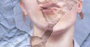 Opinion | Does My Face-Lift Make Me a Bad Feminist?